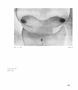 Page: - 101 | Aperture