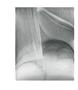 Page: - 11 | Aperture