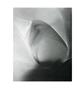 Page: - 13 | Aperture