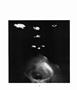 Page: - 26 | Aperture