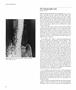 Page: - 46 | Aperture