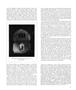 Page: - 15 | Aperture