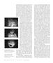 Page: - 20 | Aperture