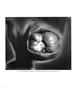 Page: - 8 | Aperture