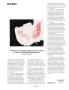 Page: - 11 | Aperture